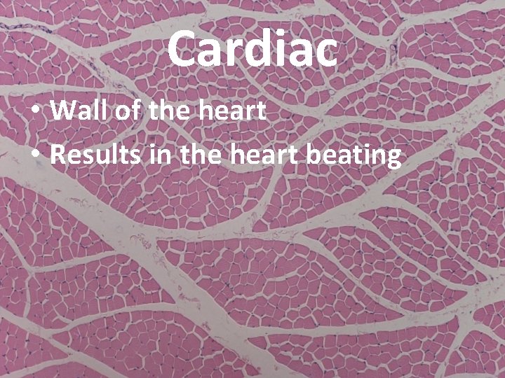 Cardiac • Wall of the heart • Results in the heart beating 