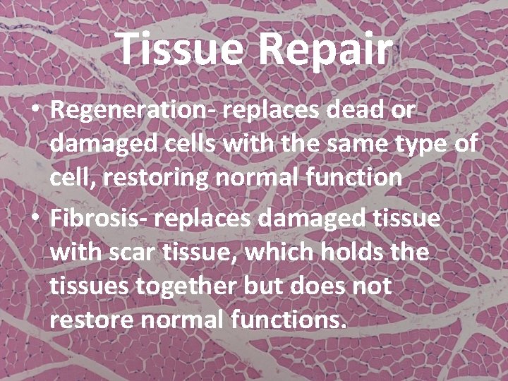 Tissue Repair • Regeneration- replaces dead or damaged cells with the same type of