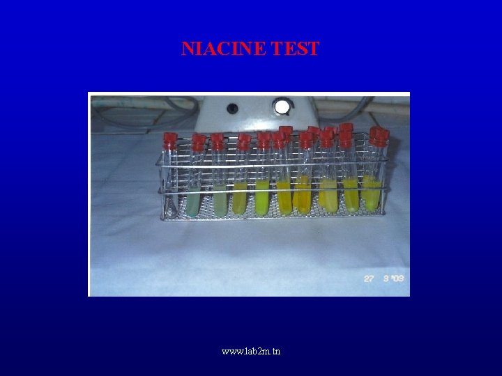 NIACINE TEST www. lab 2 m. tn 