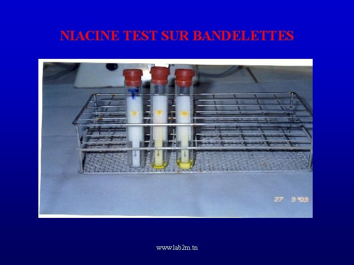 NIACINE TEST SUR BANDELETTES www. lab 2 m. tn 
