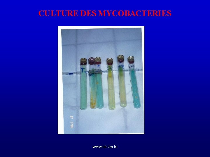 CULTURE DES MYCOBACTERIES www. lab 2 m. tn 