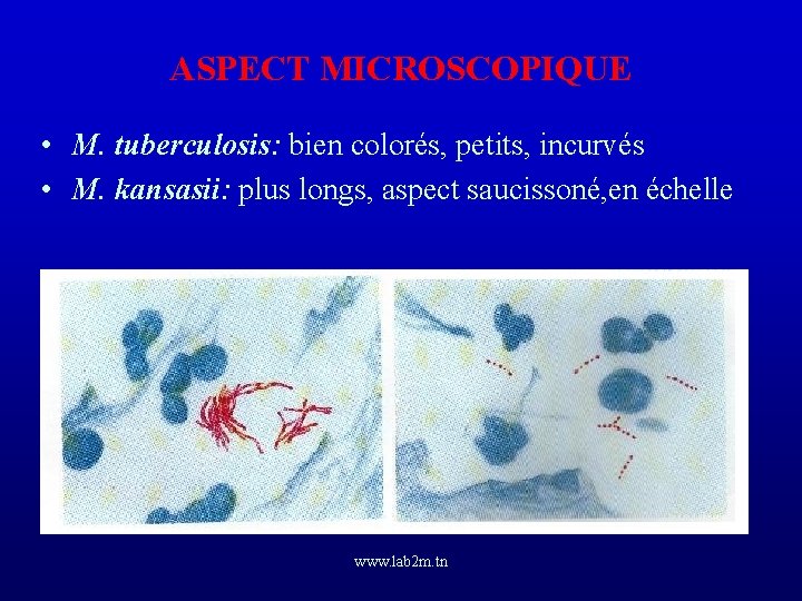 ASPECT MICROSCOPIQUE • M. tuberculosis: bien colorés, petits, incurvés • M. kansasii: plus longs,