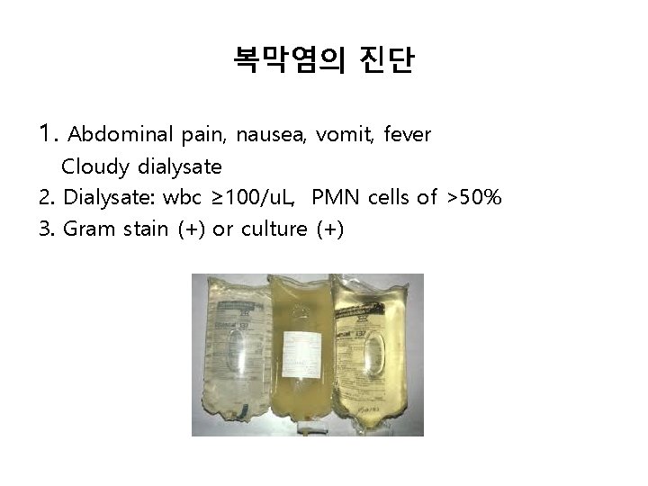복막염의 진단 1. Abdominal pain, nausea, vomit, fever Cloudy dialysate 2. Dialysate: wbc ≥