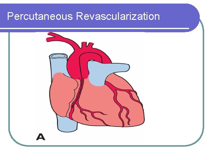 Percutaneous Revascularization 