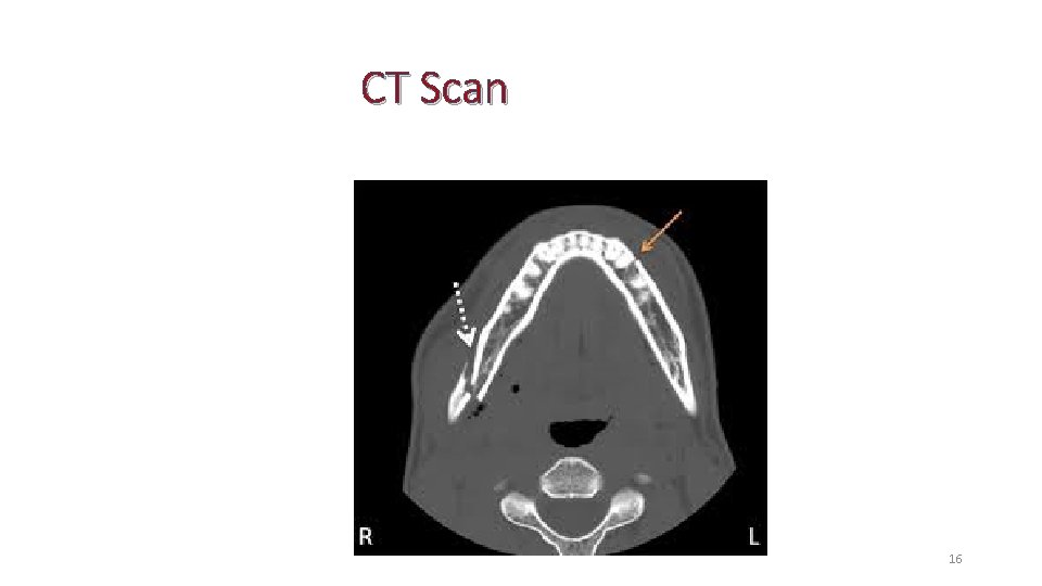 CT Scan 16 