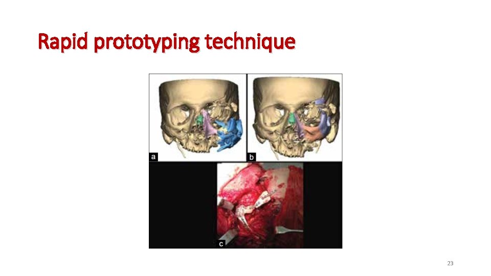 Rapid prototyping technique 23 