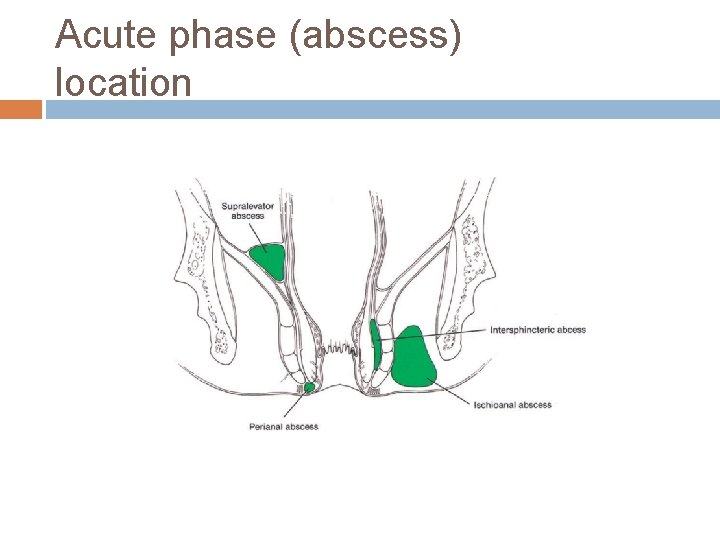 Acute phase (abscess) location 
