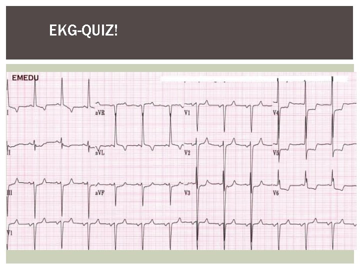 EKG-QUIZ! 