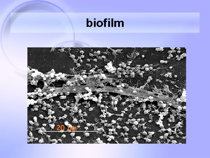 biofilm 20 mm 