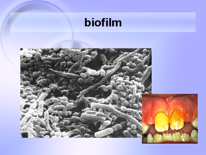 biofilm 