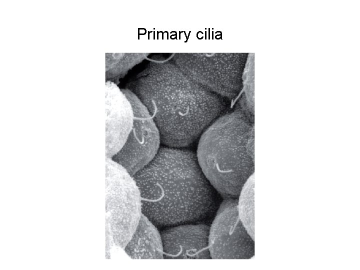 Primary cilia 