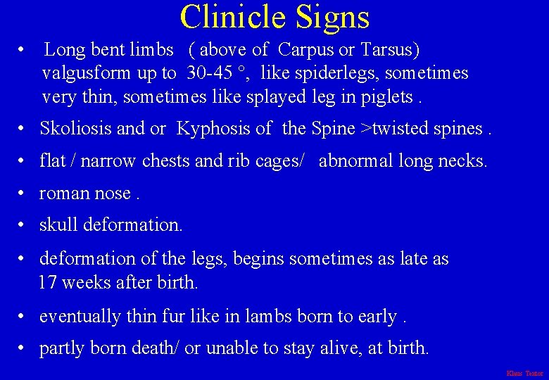 Clinicle Signs • Long bent limbs ( above of Carpus or Tarsus) valgusform up