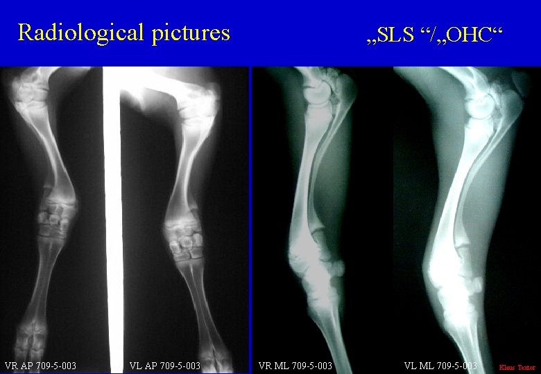 Radiological pictures VR AP 709 -5 -003 VL AP 709 -5 -003 „SLS “/„OHC“