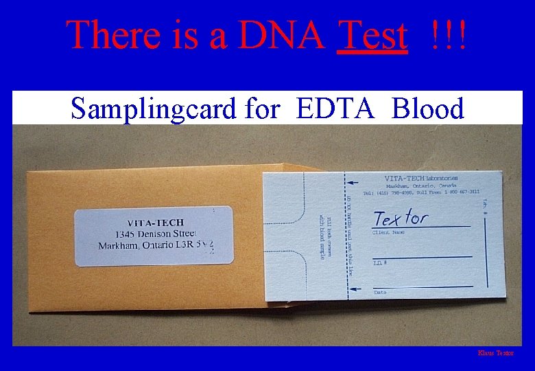 There is a DNA Test !!! Samplingcard for EDTA Blood Klaus Textor 