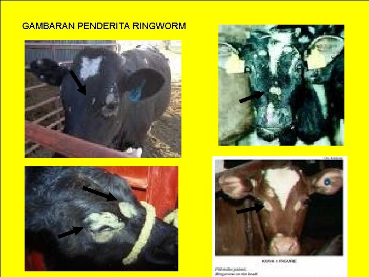 GAMBARAN PENDERITA RINGWORM 