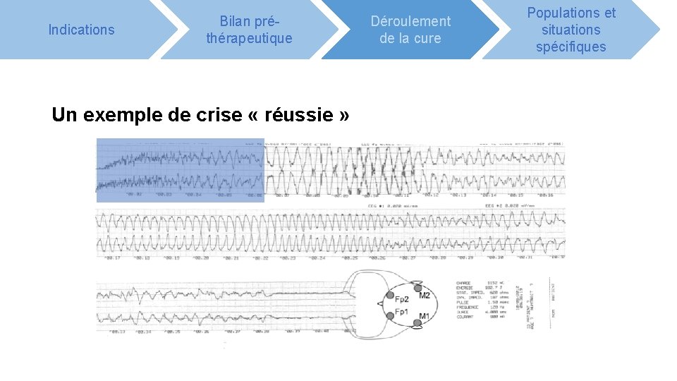 Indications Bilan préthérapeutique Un exemple de crise « réussie » Déroulement de la cure