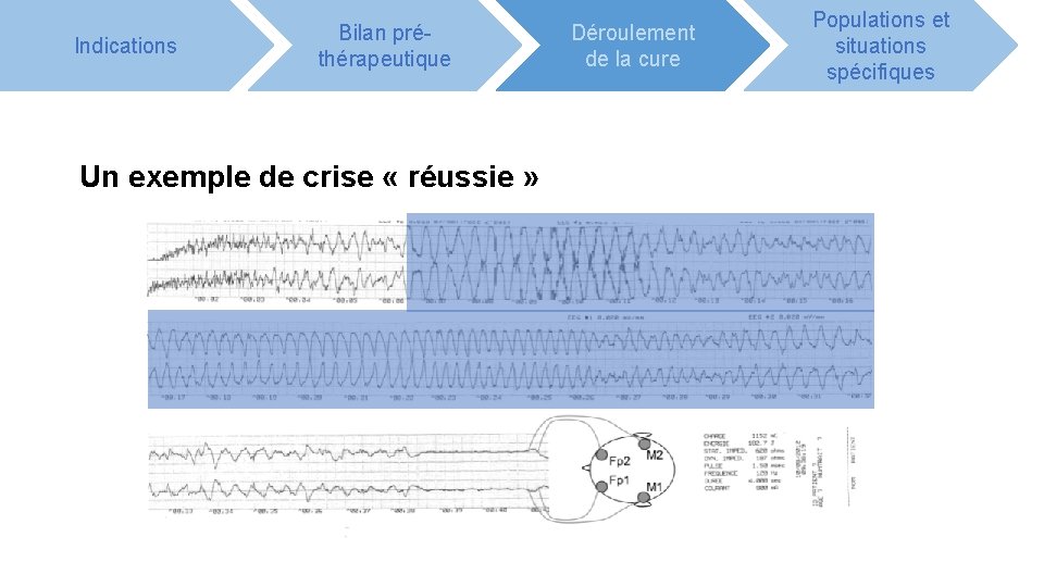 Indications Bilan préthérapeutique Un exemple de crise « réussie » Déroulement de la cure