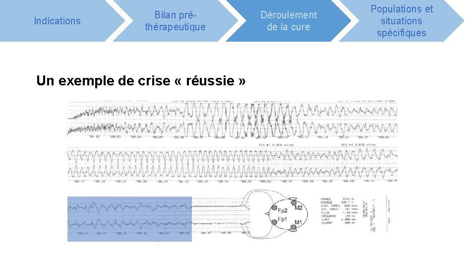 Indications Bilan préthérapeutique Un exemple de crise « réussie » Déroulement de la cure