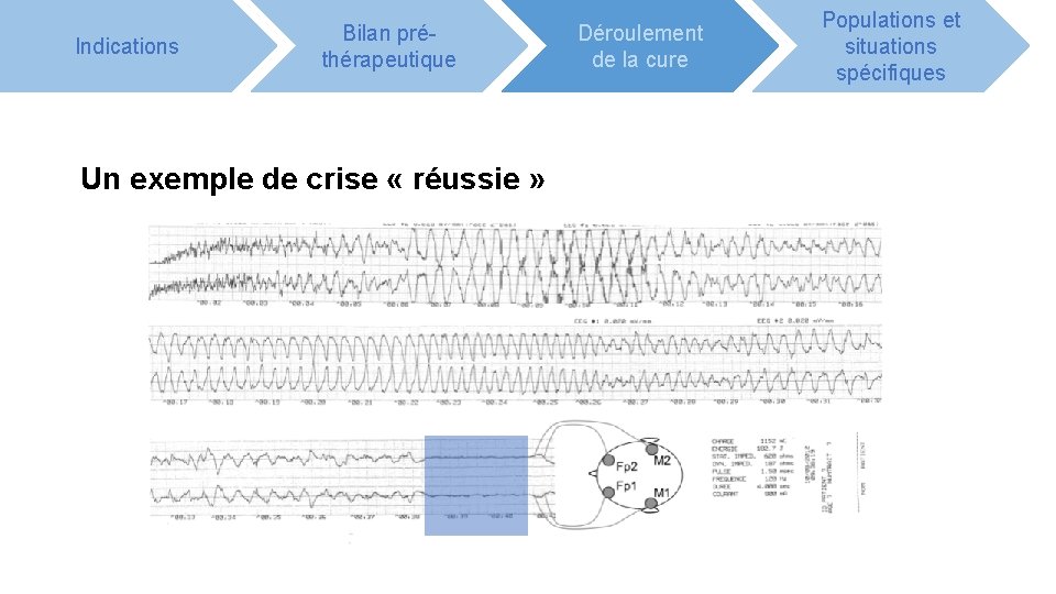 Indications Bilan préthérapeutique Un exemple de crise « réussie » Déroulement de la cure