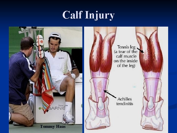 Calf Injury Tommy Haas 