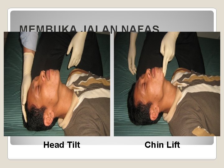 MEMBUKA JALAN NAFAS Head Tilt Chin Lift 