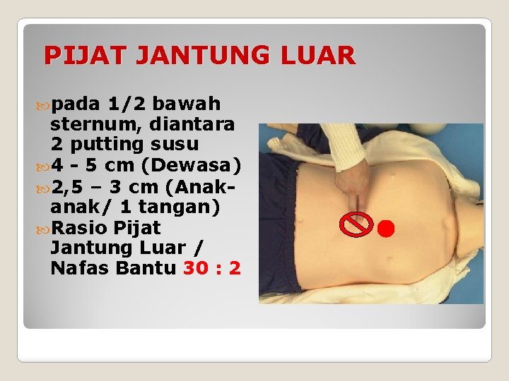 PIJAT JANTUNG LUAR pada 1/2 bawah sternum, diantara 2 putting susu 4 - 5