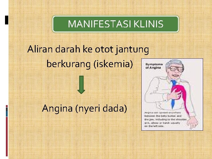 MANIFESTASI KLINIS Aliran darah ke otot jantung berkurang (iskemia) Angina (nyeri dada) 