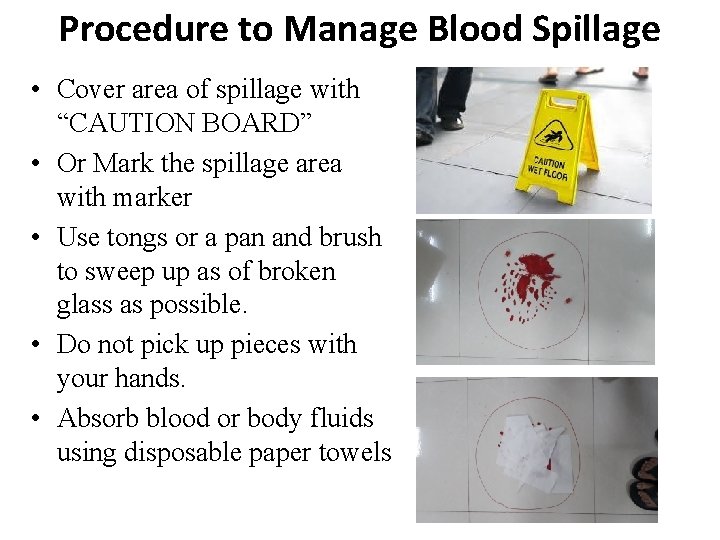 Procedure to Manage Blood Spillage • Cover area of spillage with “CAUTION BOARD” •