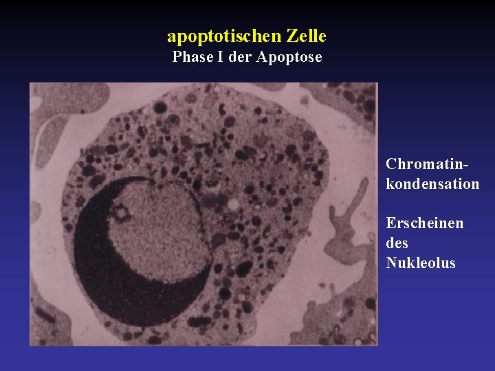 apoptotischen Zelle Phase I der Apoptose Chromatinkondensation Erscheinen des Nukleolus 