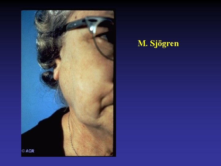 M. Sjögren 