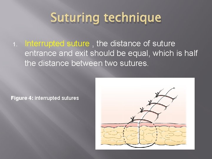 Suturing technique 1. Interrupted suture , the distance of suture entrance and exit should