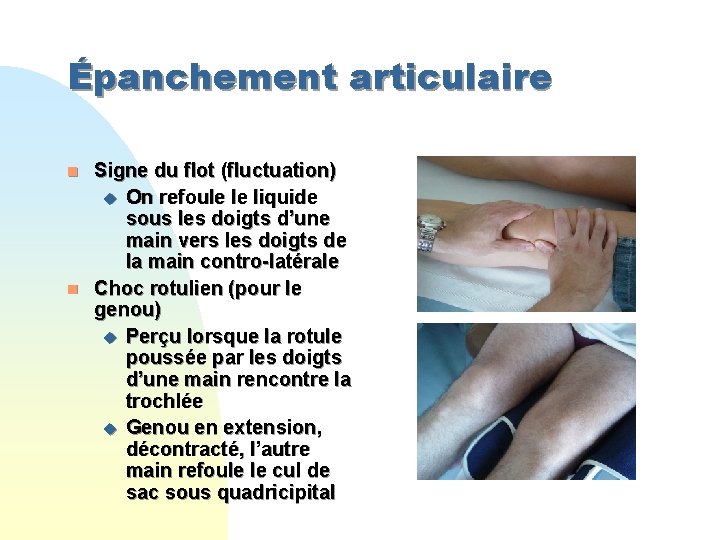 Épanchement articulaire n n Signe du flot (fluctuation) u On refoule le liquide sous