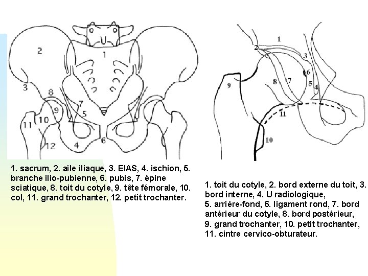 1. sacrum, 2. aile iliaque, 3. EIAS, 4. ischion, 5. branche ilio-pubienne, 6. pubis,