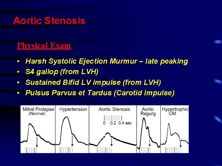 Aortic Stenosis Physical Exam • • Harsh Systolic Ejection Murmur – late peaking S