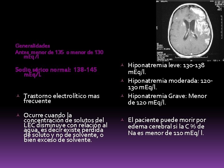 Generalidades Antes menor de 135 o menor de 130 m. Eq /l Sodio sérico