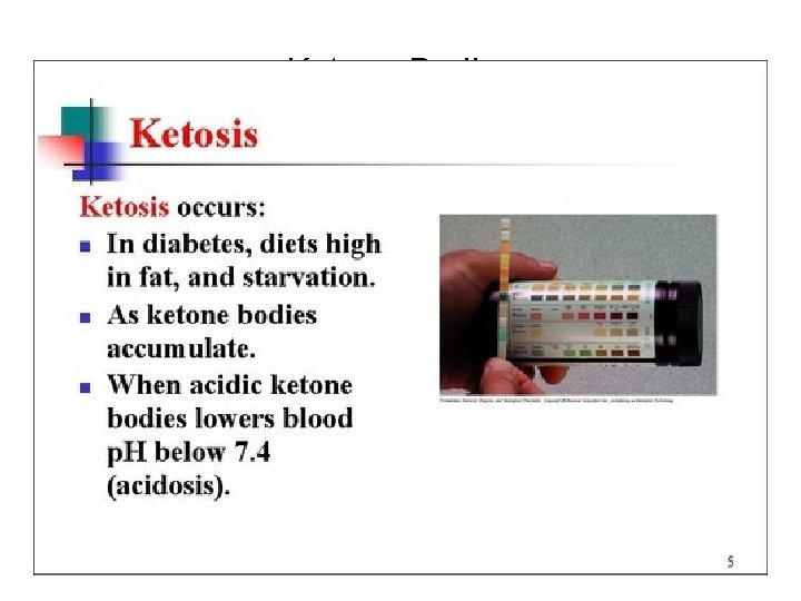 Ketone Bodies 