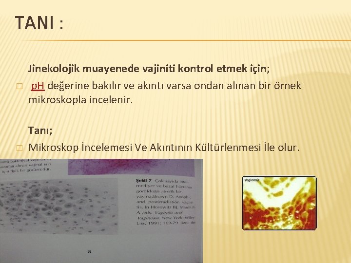 TANI : Jinekolojik muayenede vajiniti kontrol etmek için; � p. H değerine bakılır ve