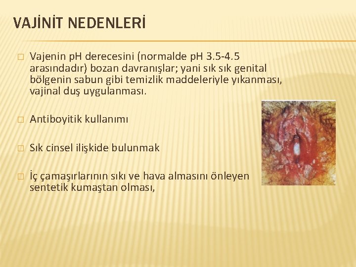 VAJİNİT NEDENLERİ � Vajenin p. H derecesini (normalde p. H 3. 5 -4. 5