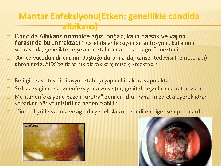 Mantar Enfeksiyonu(Etken: genellikle candida albikans) � � � Candida Albikans normalde ağız, boğaz, kalın