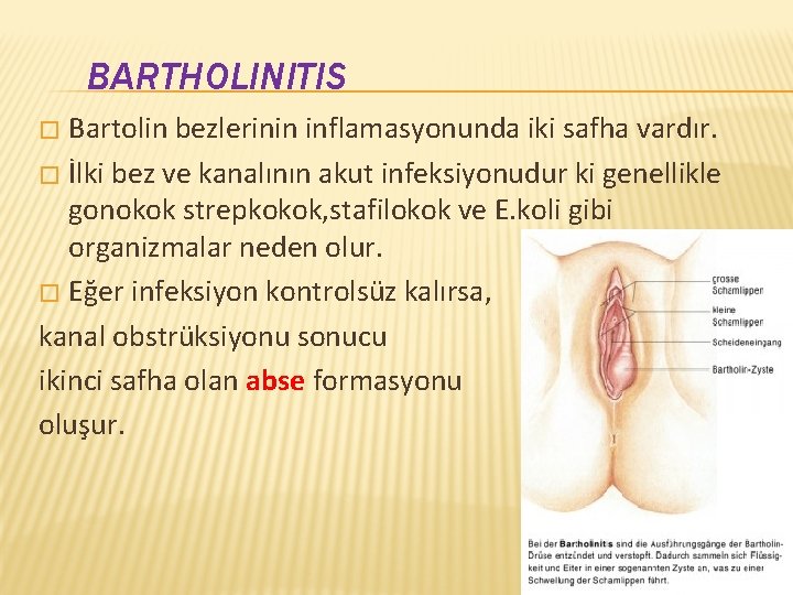 BARTHOLINITIS Bartolin bezlerinin inflamasyonunda iki safha vardır. � İlki bez ve kanalının akut infeksiyonudur
