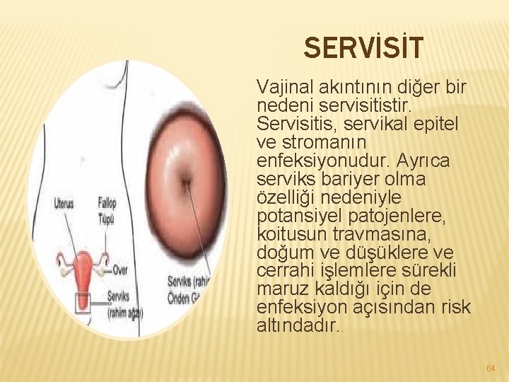 SERVİSİT Vajinal akıntının diğer bir nedeni servisitistir. Servisitis, servikal epitel ve stromanın enfeksiyonudur. Ayrıca