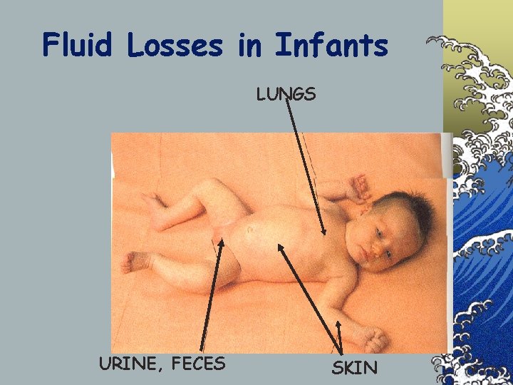 Fluid Losses in Infants LUNGS URINE, FECES SKIN 