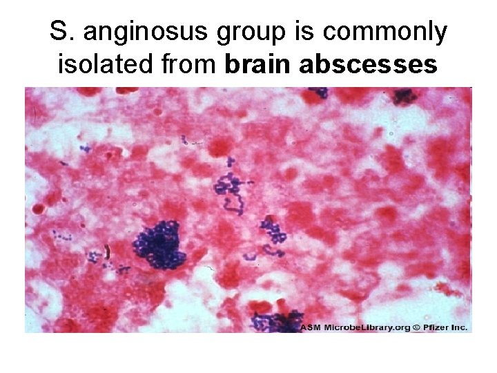 S. anginosus group is commonly isolated from brain abscesses 