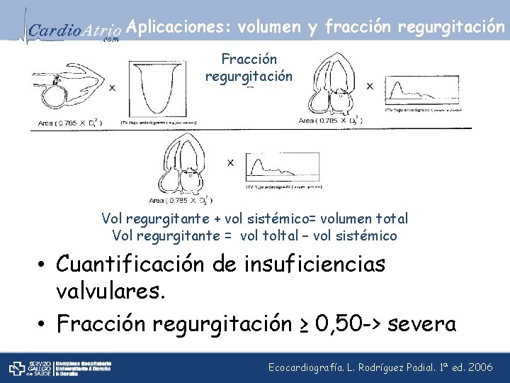 Aplicaciones: volumen y fracción regurgitación Fracción regurgitación Vol regurgitante + vol sistémico= volumen total
