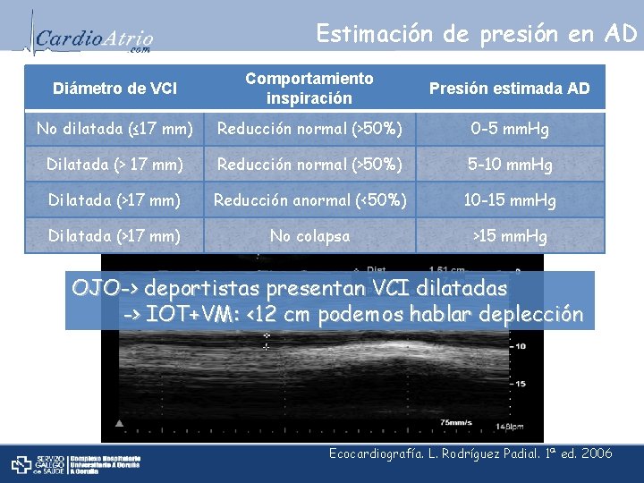 Estimación de presión en AD Diámetro de VCI Comportamiento inspiración Presión estimada AD No