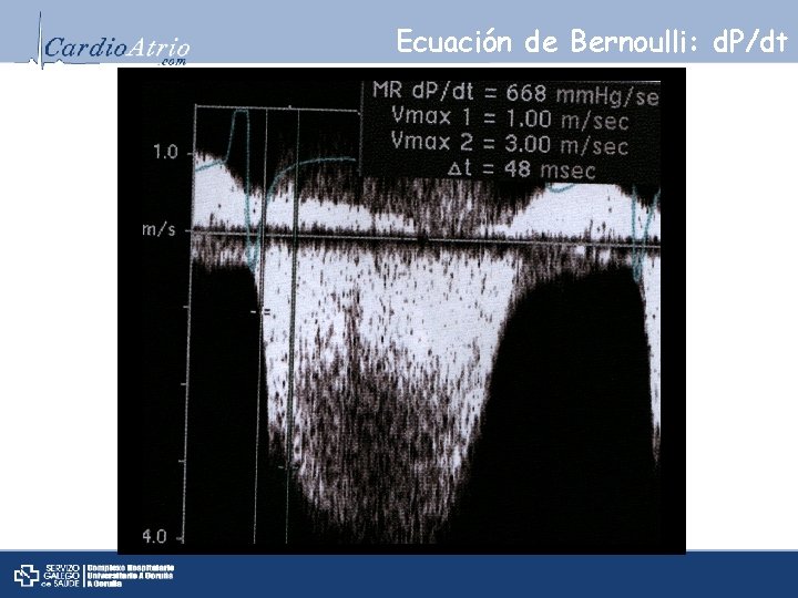 Ecuación de Bernoulli: d. P/dt 