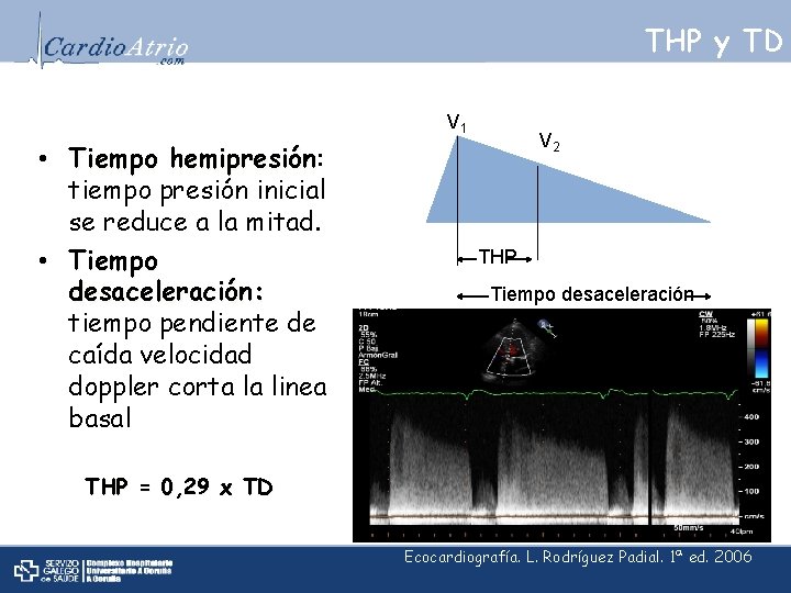 THP y TD V 1 • Tiempo hemipresión: hemipresión tiempo presión inicial se reduce