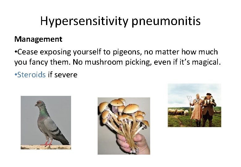 Hypersensitivity pneumonitis Management • Cease exposing yourself to pigeons, no matter how much you