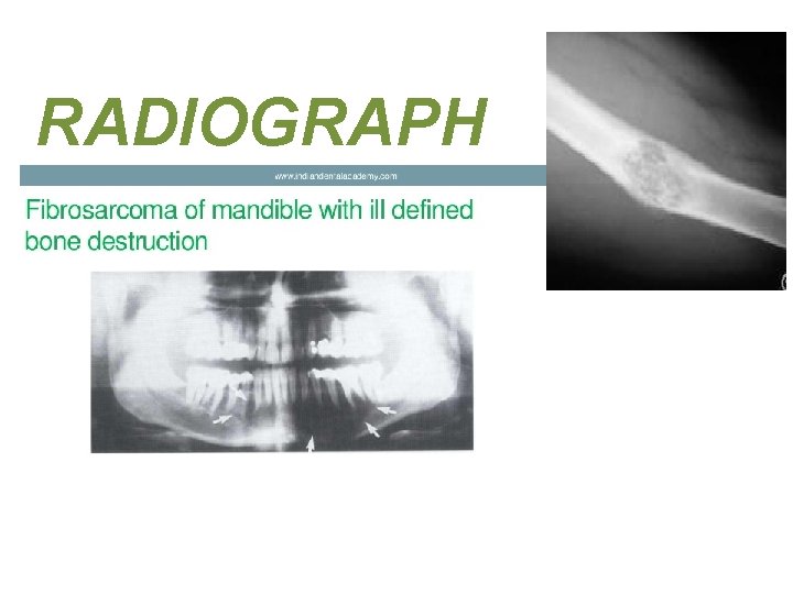 RADIOGRAPH 