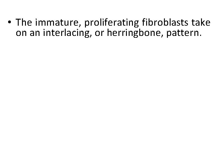  • The immature, proliferating fibroblasts take on an interlacing, or herringbone, pattern. 